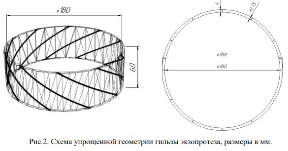 Новый подход к созданию бедренного экзопротеза на основе 3Д-печати и углеродных волокон
